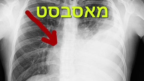 תושבי שוהם, תכירו, אסבסט! - חדשות בשוהם